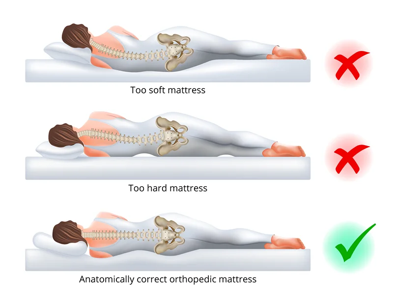 How should you sleep if you have lower back pain? - Orthopedic